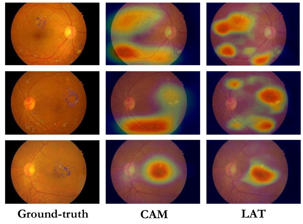 Lat [52] vs. cam [101] visual comparison. the ground truth
