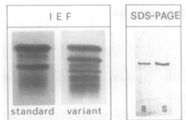 (PDF) Analysis of transketolase and identification of an enzyme variant ...