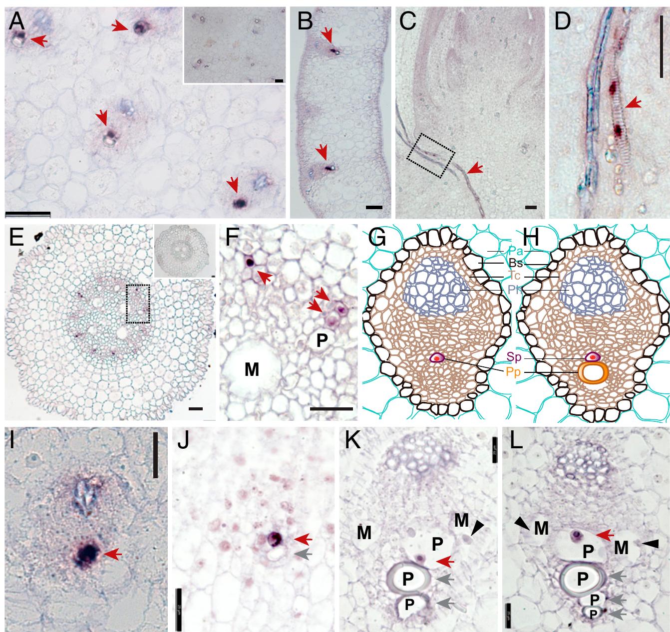 Protoxylem Root (PDF) Necrotic upper tips1 mimics heat and drought stress and encodes a ...