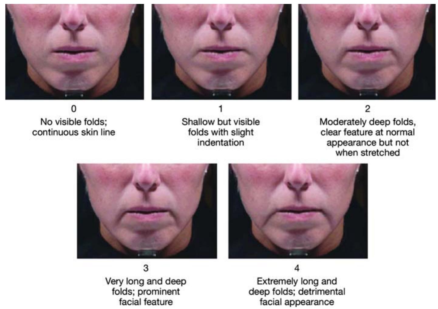 Figure 1 - from A validated facial grading scale: the future