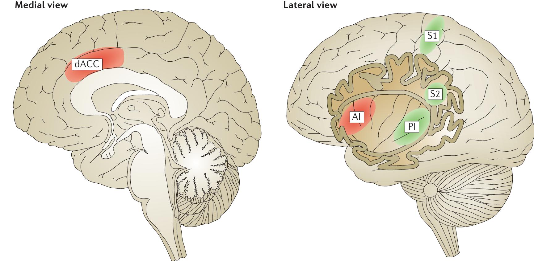 (PDF) The pain of social disconnection: examining the shared neural ...