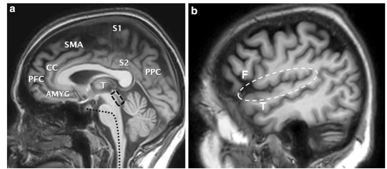 Pfc Matrix The “pain matrix.” (a) midline sagittal t1 of the brain: t