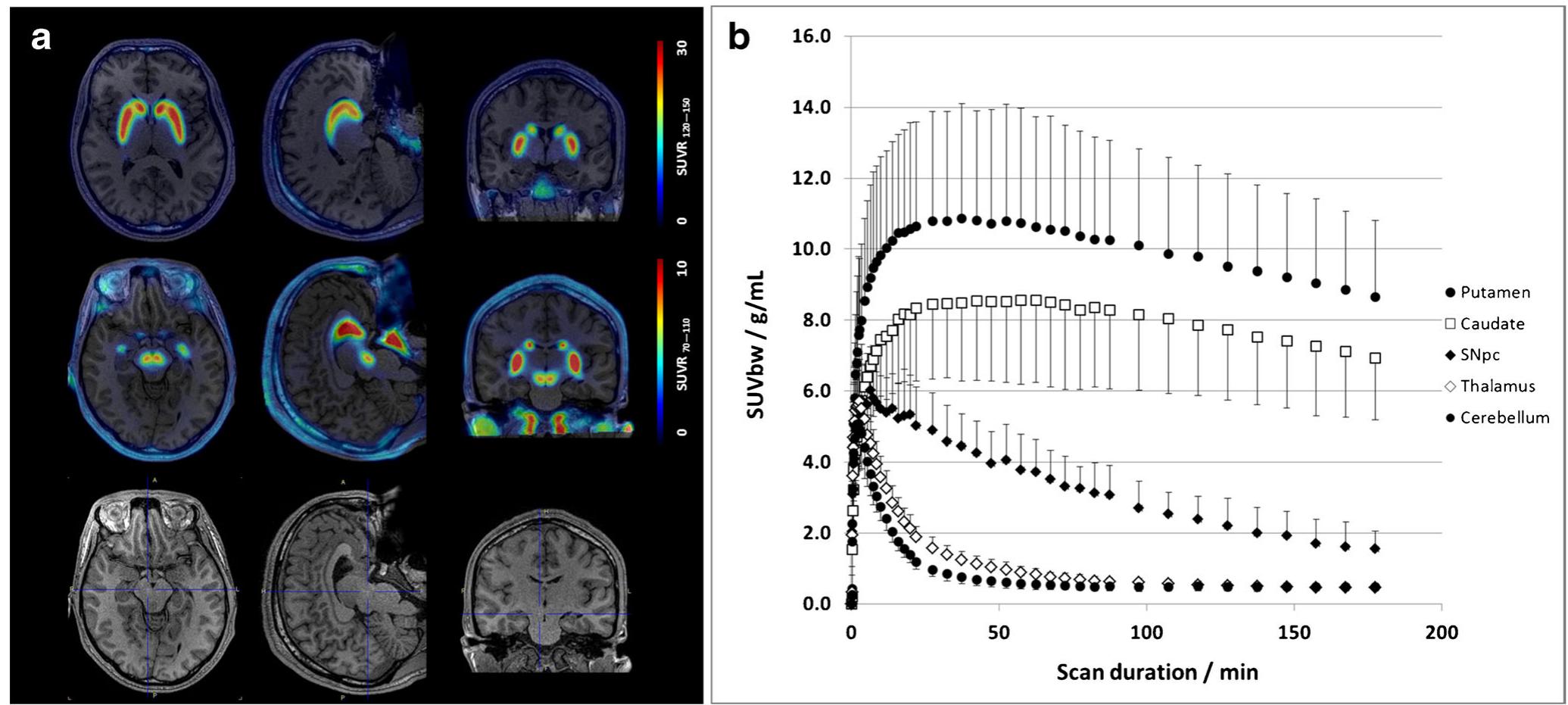 (PDF) Pharmacokinetic evaluation of [18F]PR04.MZ for PET/CT imaging and ...