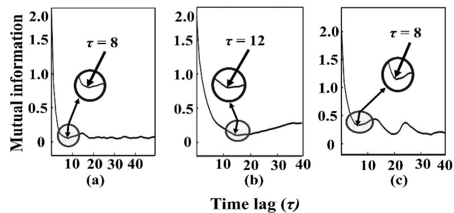 (PDF) Analysis of epileptic seizures based on EEG using recurrence plot ...