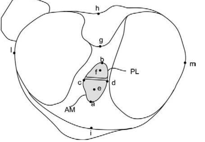 Tibia in the axial view with tibial measurement points
