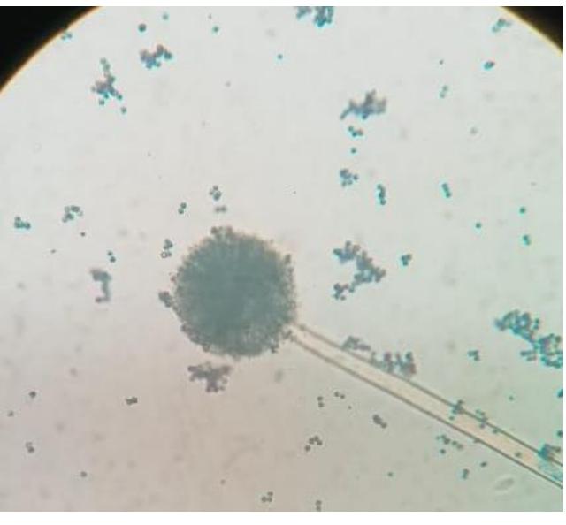 (PDF) Isolation and Identification of Aspergillus Species from Soil ...