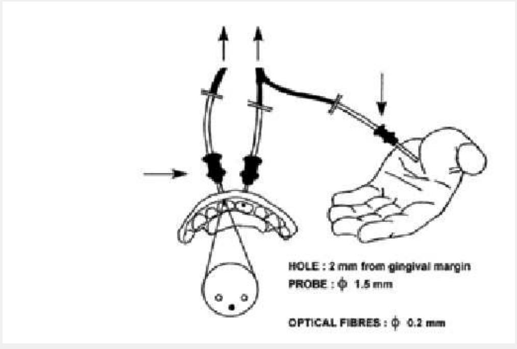 Schematic representation of a 2-probes laser doppler