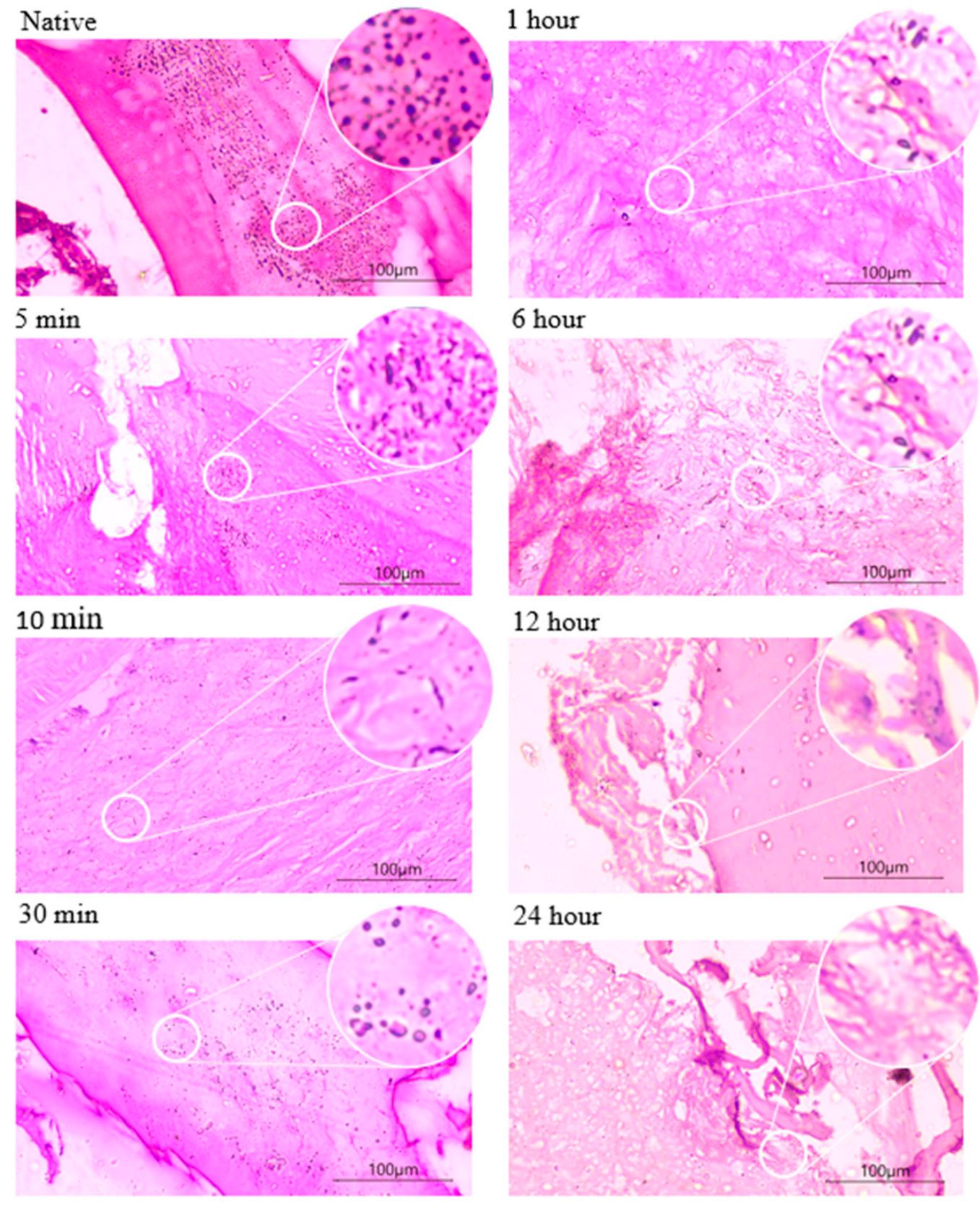 H&e staining images of demineralized bones at different