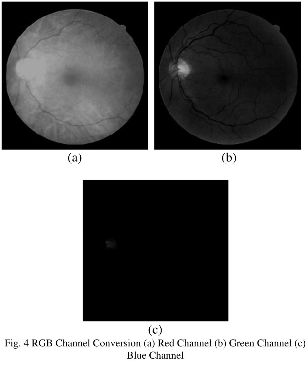 (PDF) Morphological Segmentation of Blood Vessels in Retinal Image