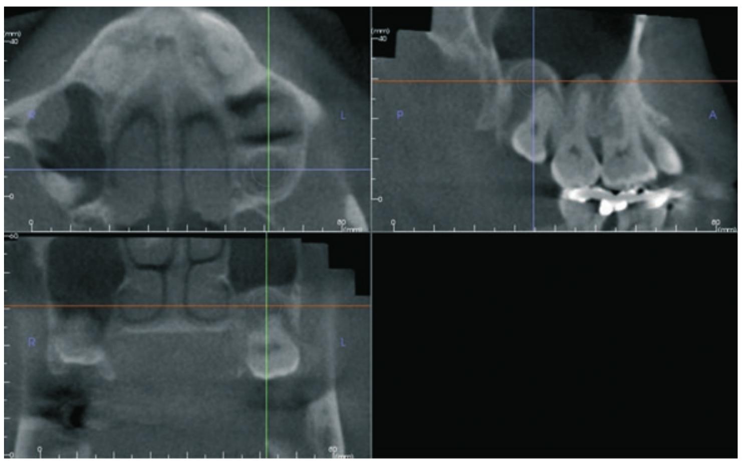 Cbct images (correlated orthogonal planes — axial, coronal