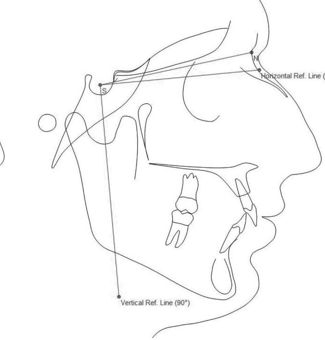 Horizontal and vertical reference lines.
