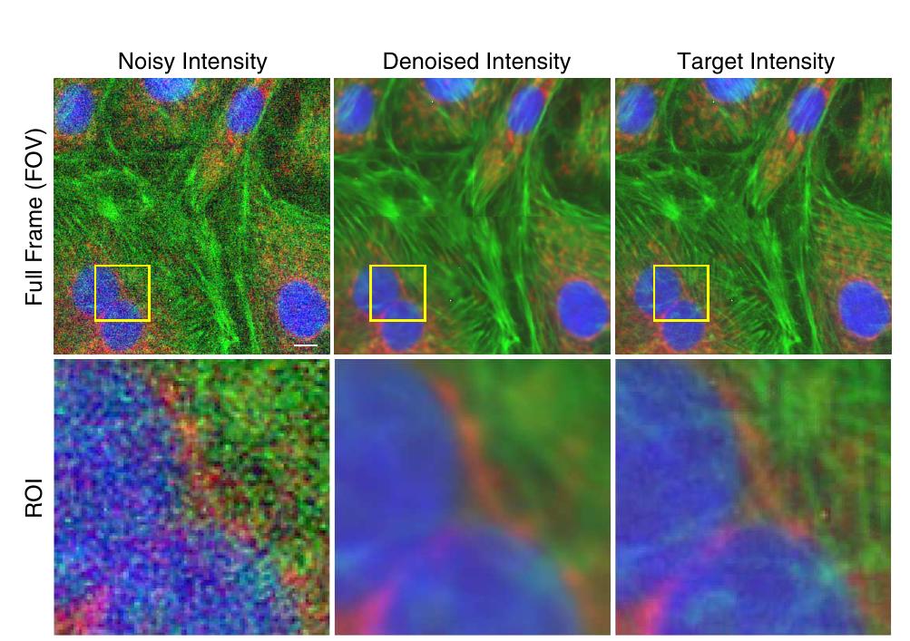Dapi 405 (PDF) Real-time Image Denoising of Mixed Poisson-Gaussian Noise in ...