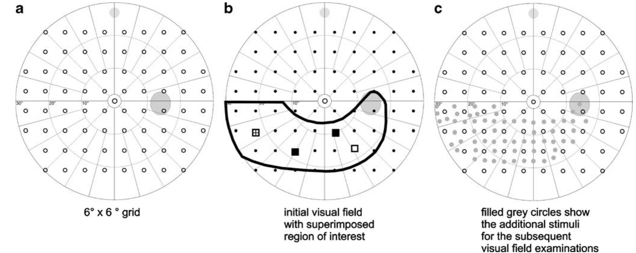 Disoriented Vision Grid (PDF) Specification of progression in glaucomatous visual field loss ...