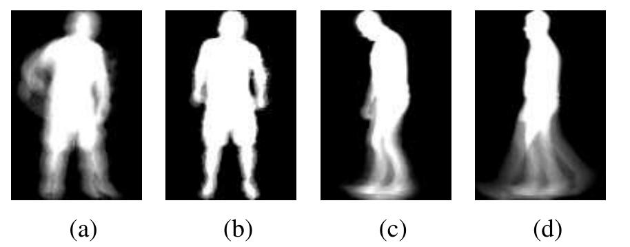 Some examples of abnormal geis (a) stroke, (b) parkinson,