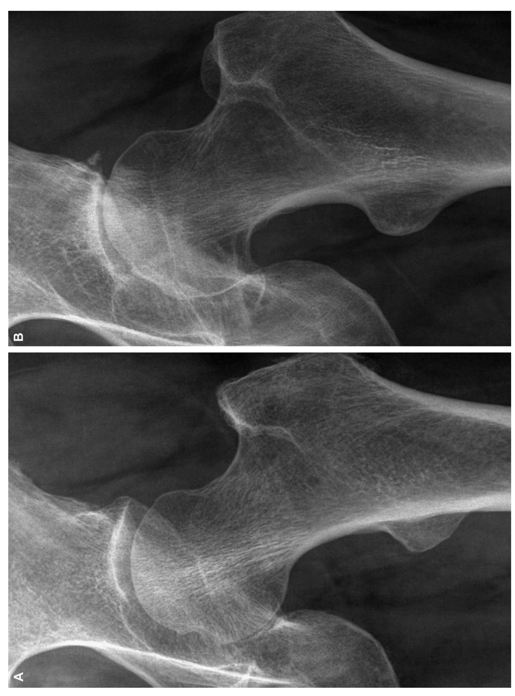 Figure 31 - Atlas of individual radiographic features in
