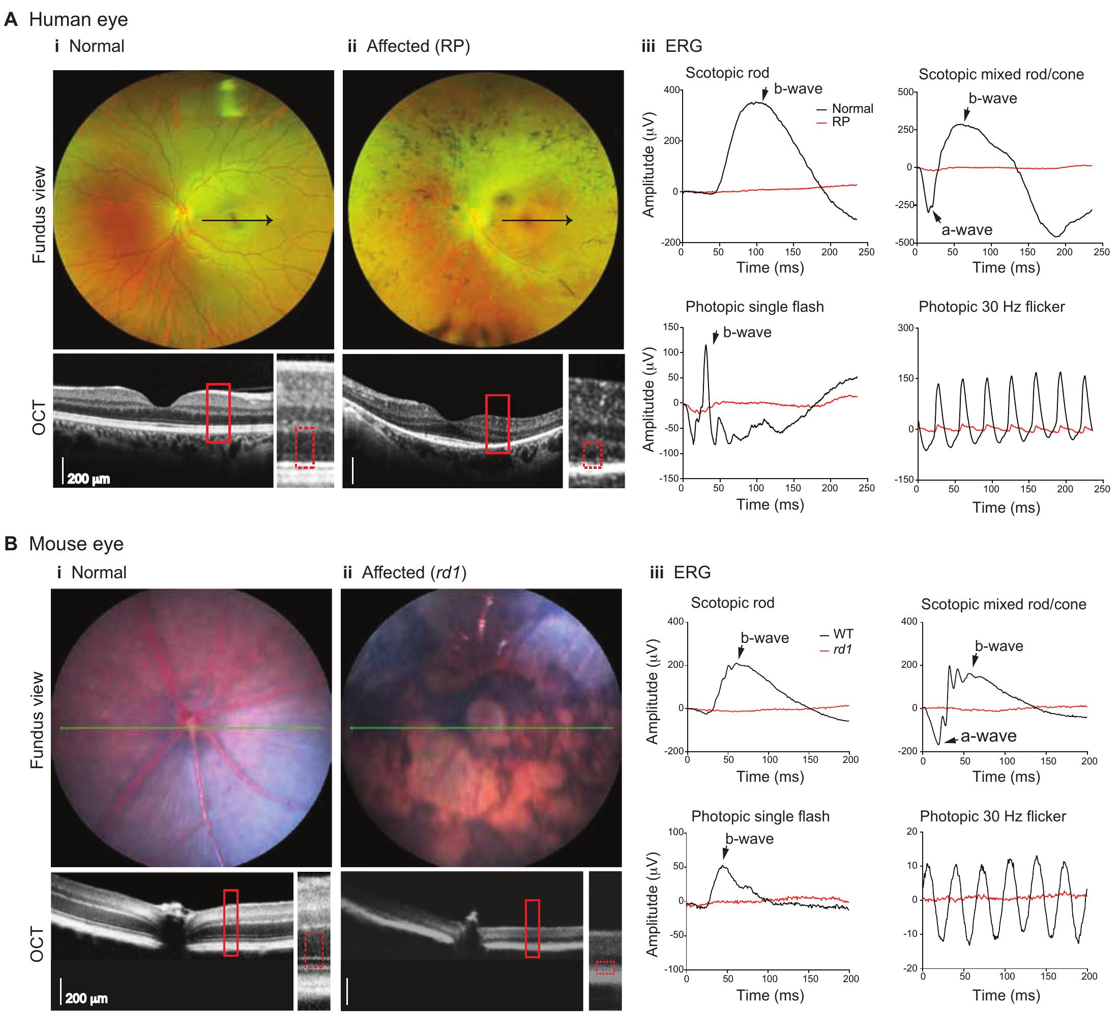 Figure 1 - from Biology and therapy of inherited retinal