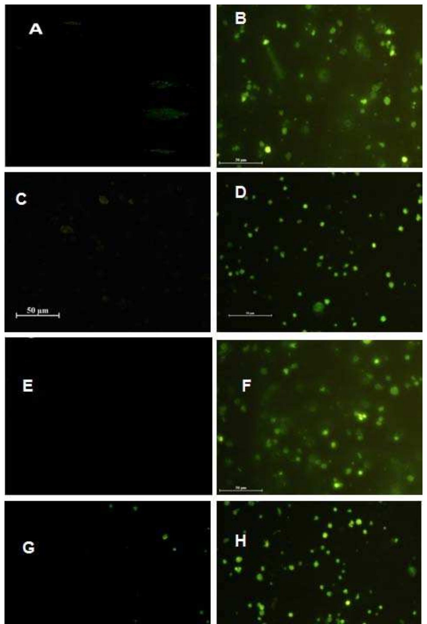 Intracellular reactive oxygen species measurement was done