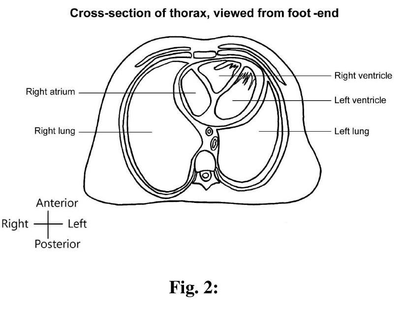 (PDF) Cross sectional anatomy - need for uniformity in the display of ...
