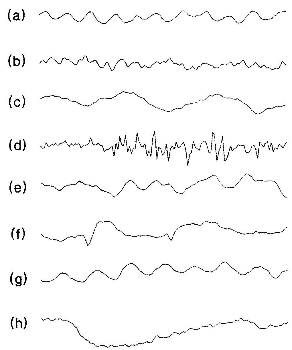 O2 Waveform Artifact Figure 1 - from Evaluation of parametric methods in EEG