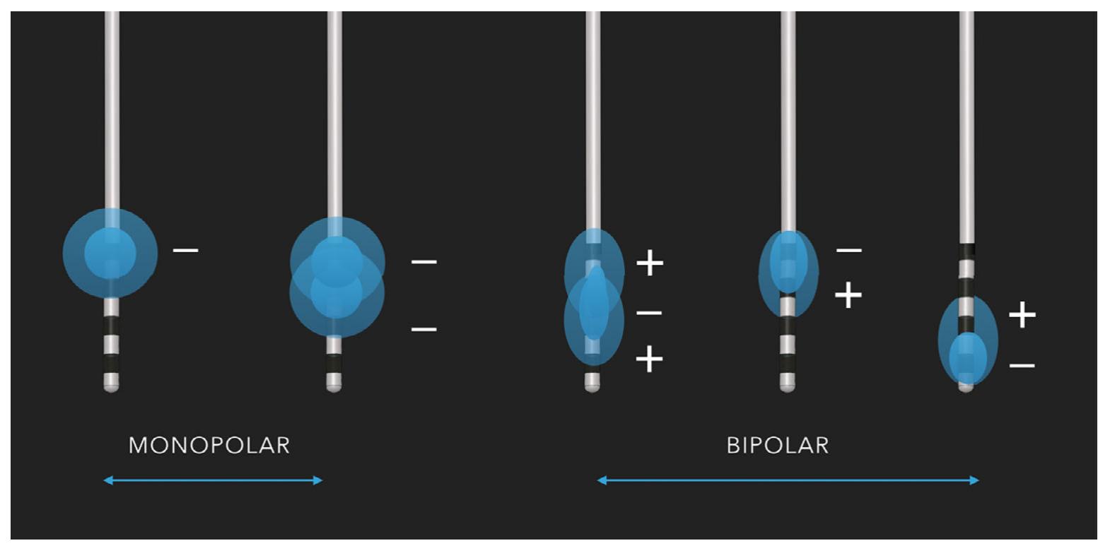 (PDF) Optimizing Deep Brain Stimulation Parameter Selection with ...