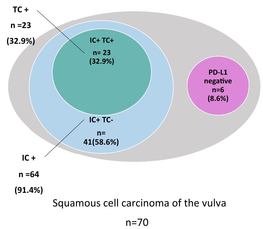 Ics Subgroups (PDF) Clinical impact of PD-L1 and PD-1 expression in squamous cell ...