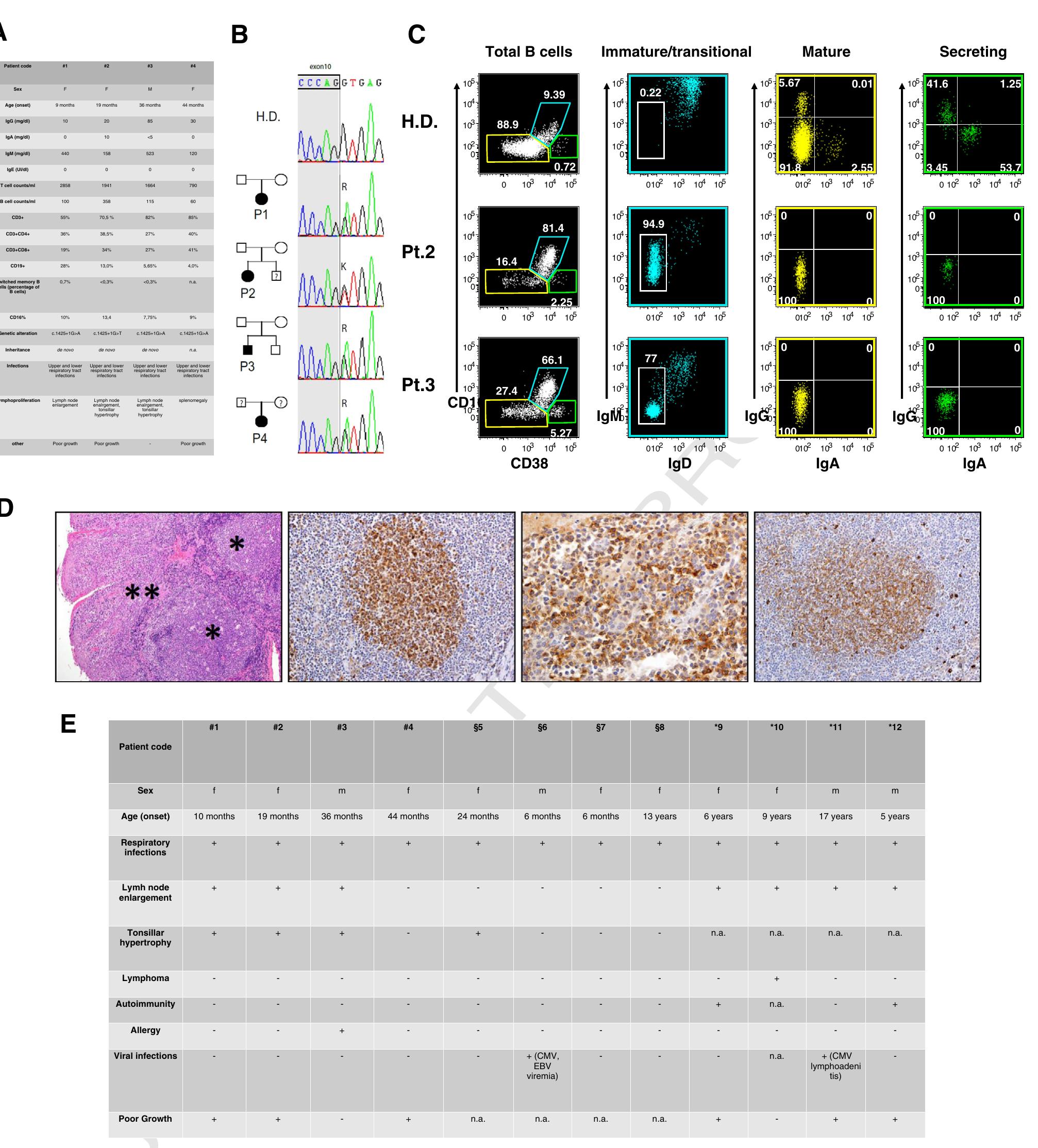 Figure 1 Clinical, molecular and immunological findings from the index PIK3R1 mutated patients. A. Clinical and immunological presentation at onset for index patients. B. Electropherograms showing the mutations in P/K3R1 identified in the index patients. C. Peripheral B cell maturation evaluated by means of flow cytometry. The dot plots depict the gating strategy applied for the definition of immature/transitional (light blue), mature (yellow) and secreting B cells (green) in a healthy donor (HD) and two index patients (Pt.2 and Pt.3) (first column). The second column shows the identification of immature cells (second column), while the third and fourth column shows the IgG+ or IgA+ switched cells (third and fourth column) as defined by the use of monoclonal anti-surface immunoglobulin antibodies within the B cell subsets gated in the first column. D. Histological evaluation of tonsillar sections from a PIK3R1-mutated patient (Patient 2). The tonsillar sections show follicular (*) and marginal zone-B cell (**) hyperplasia (far left panel). Germinal center (mid left panel) as well as marginal zone B cells (mid right panel) express IgD. IgM staining in the germinal center labels the follicular dendritic cell network and scattered intrafollicular and extrafollicular plasma cells (far right panel). E. Summary of clinical features among reported PIK3R1 mutated patients. n.a.: not available; # index patients; § patients reported by Deau et al [6]; * patients reported by Lucas et al [7]. 