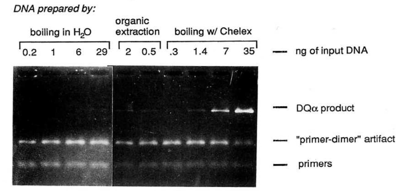 (PDF) Chelex 100 as a medium for simple extraction of DNA for PCR-based ...