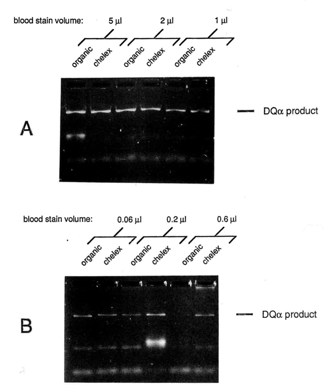 (PDF) Chelex 100 as a medium for simple extraction of DNA for PCR-based ...