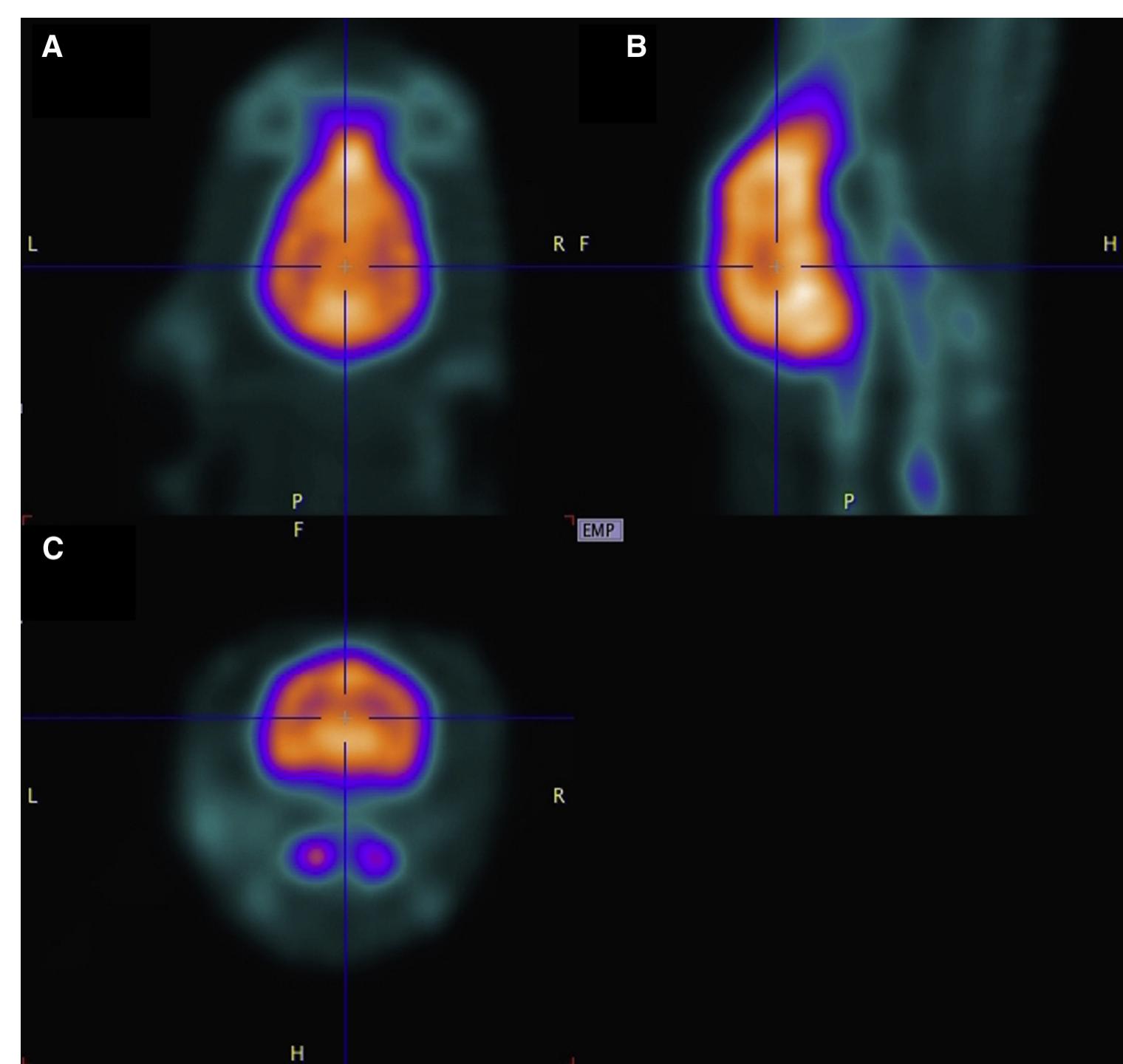 Beagle Brain (PDF) Nuclear medicine for the investigation of canine behavioral disorders