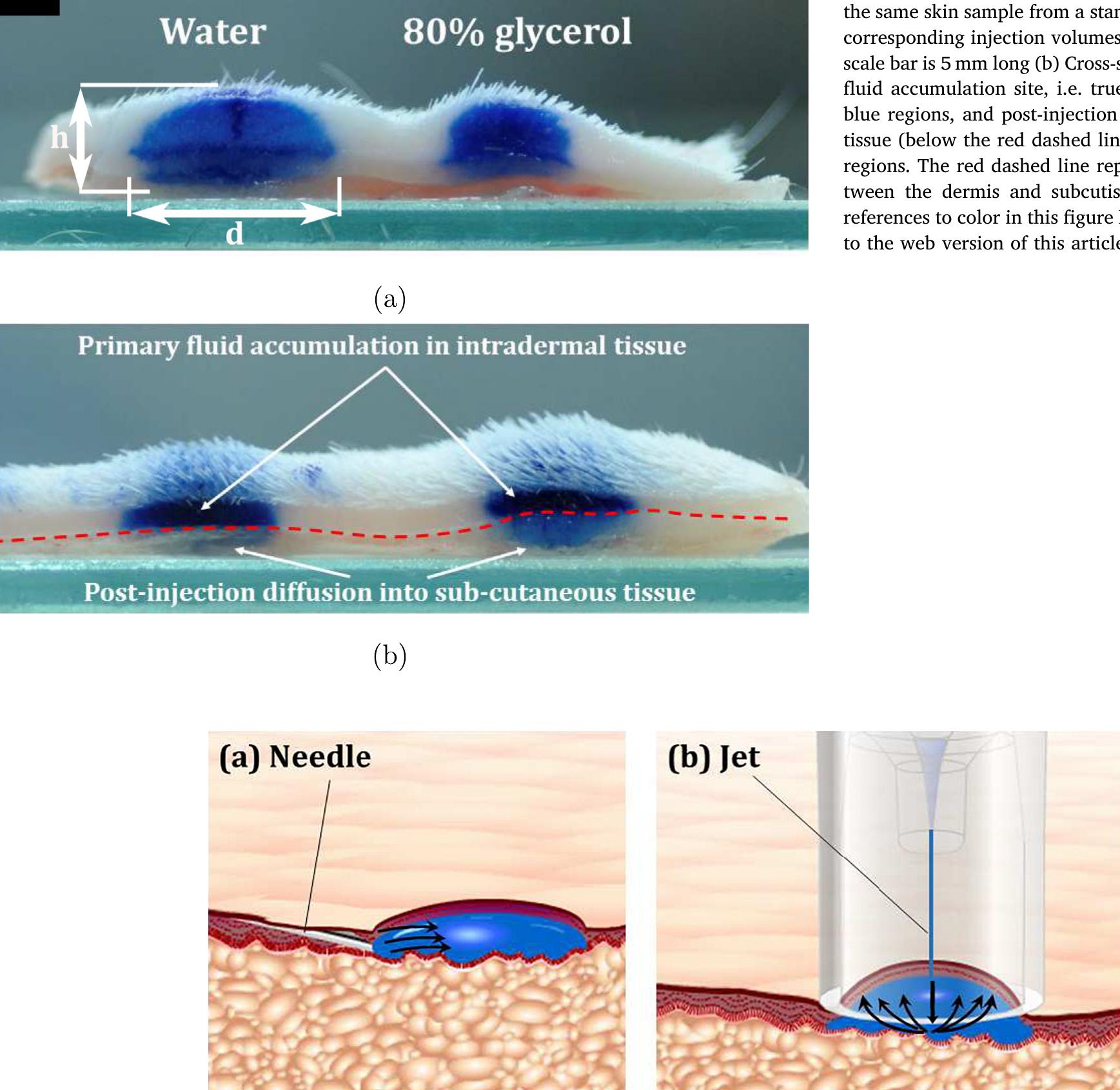 Intradermal Pattern Schematic representation of fluid flow patterns (black