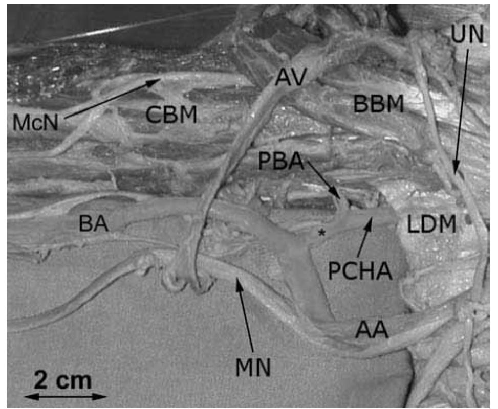 (PDF) The posterior circumflex humeral artery turning under the tendon ...