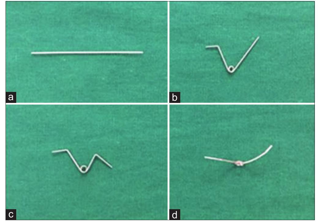 (PDF) Orthodontic uprighting of severely impacted mandibular permanent ...