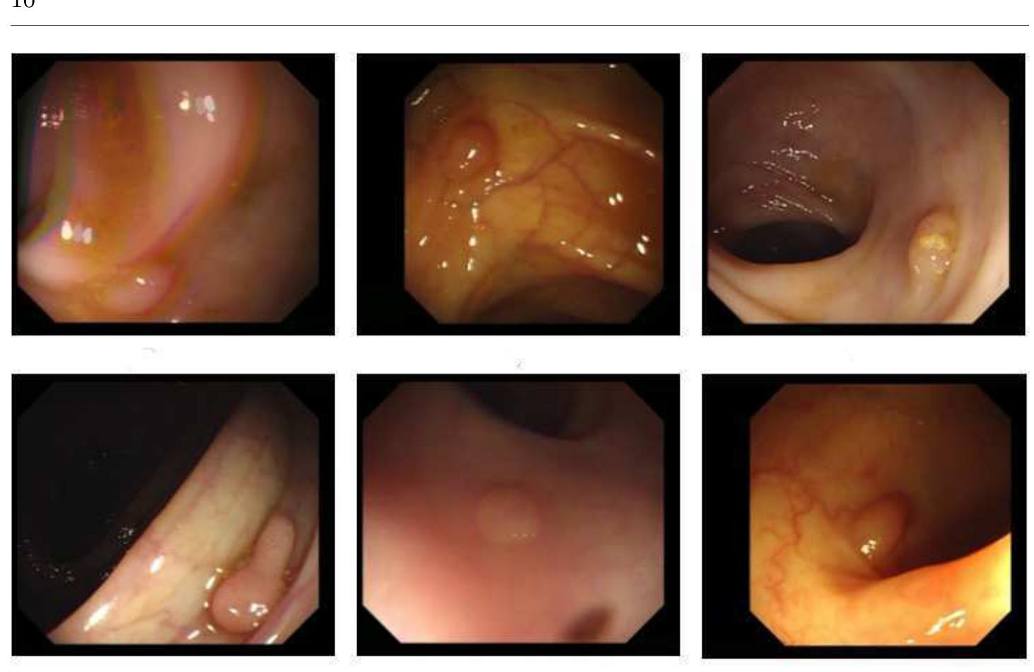 Example of polyps extracted from the database of [9].