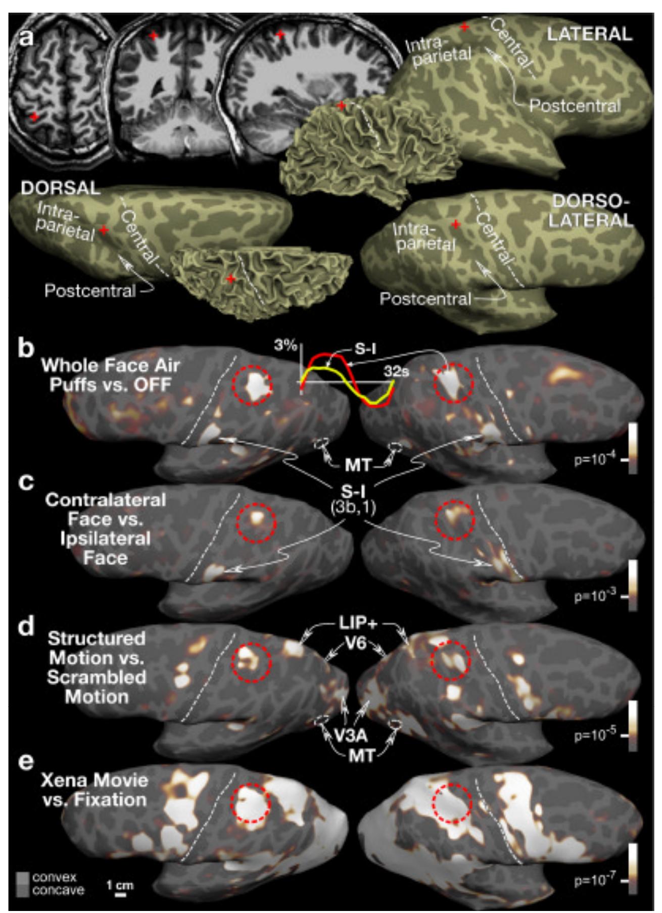 (PDF) Multisensory representations of space: multimodal brain imaging ...