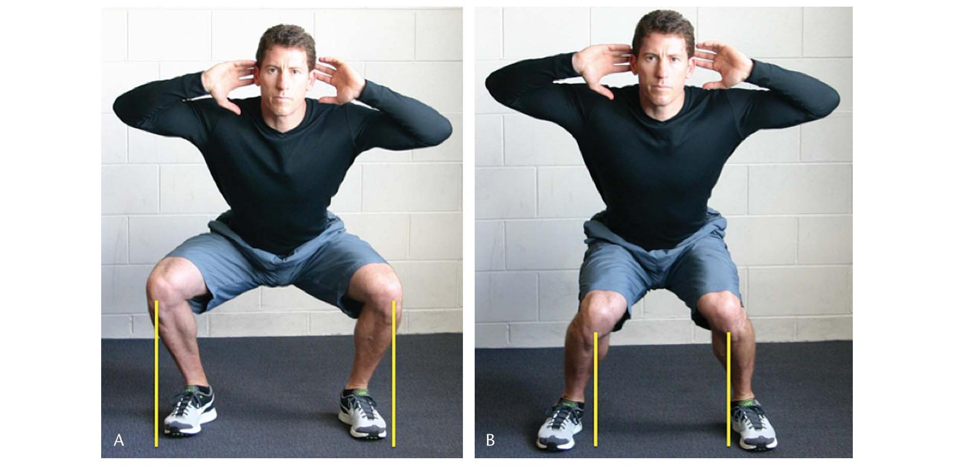 Squat Pattern Variations (PDF) The Bodyweight Squat: A Movement Screen for the Squat Pattern