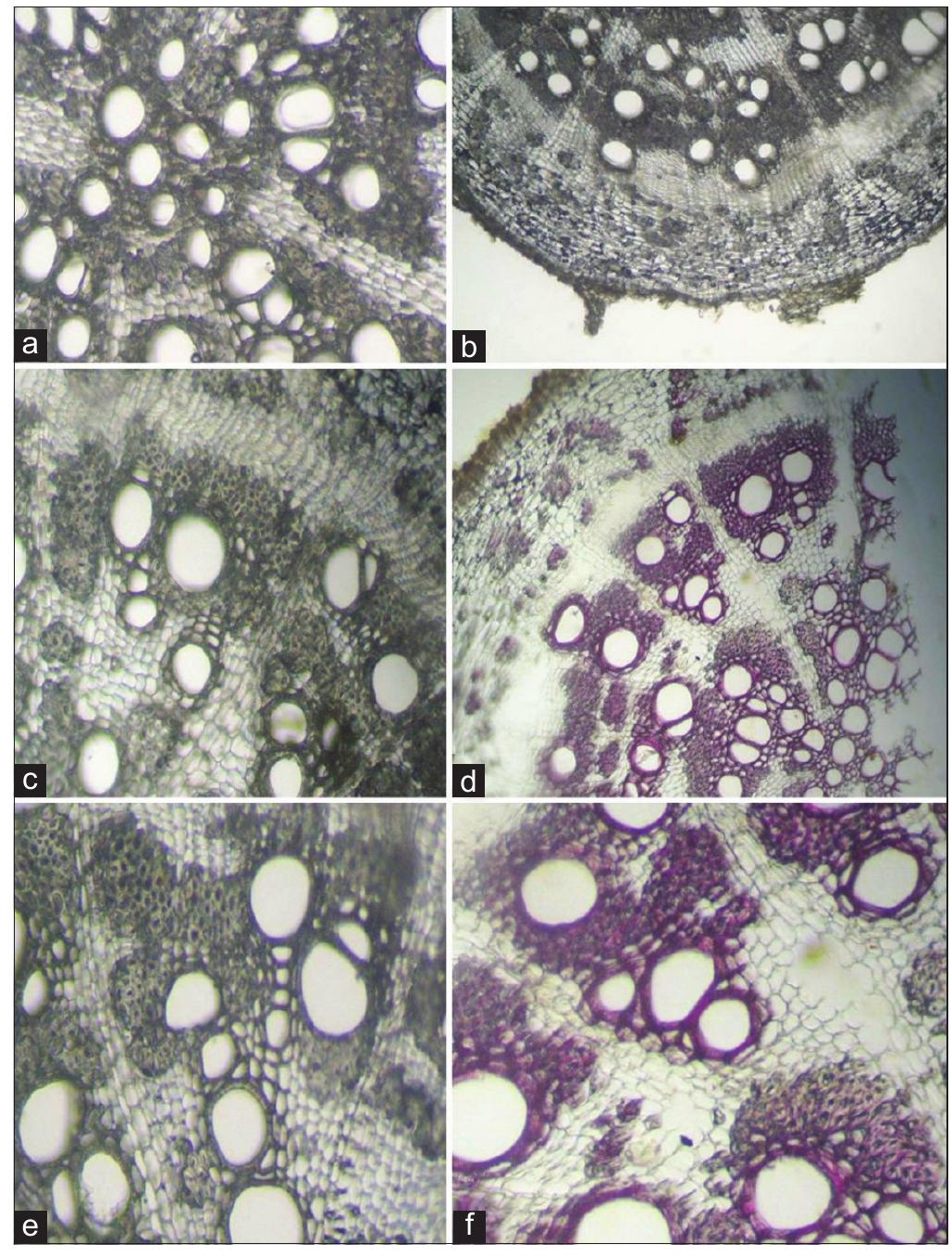 Transverse section of stem (bakuchi). (a) diagrammatic