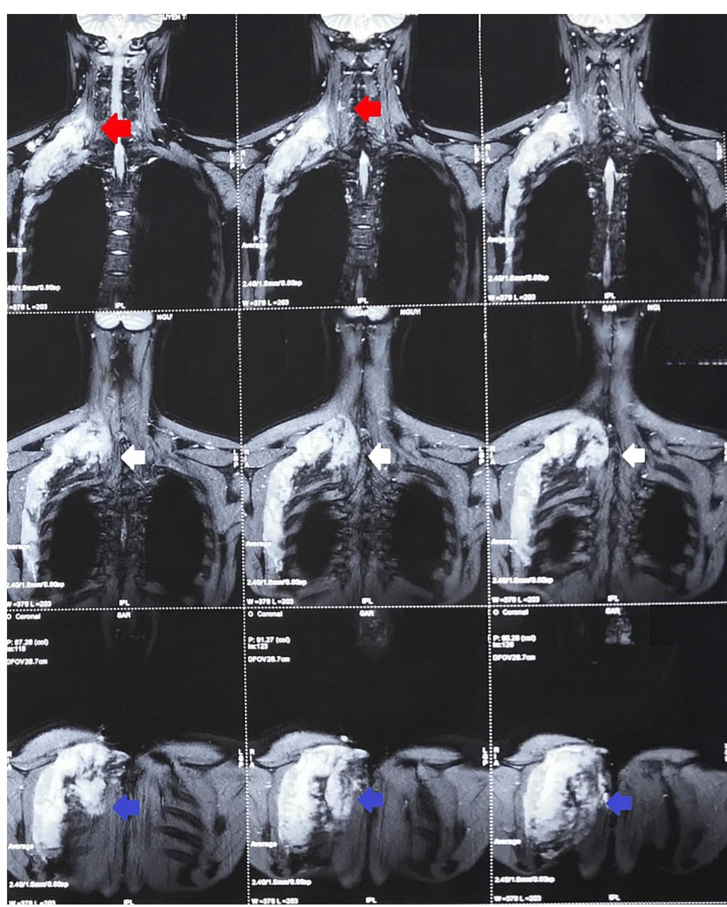 Magnetic resonance imaging (mri) scans conducted on the