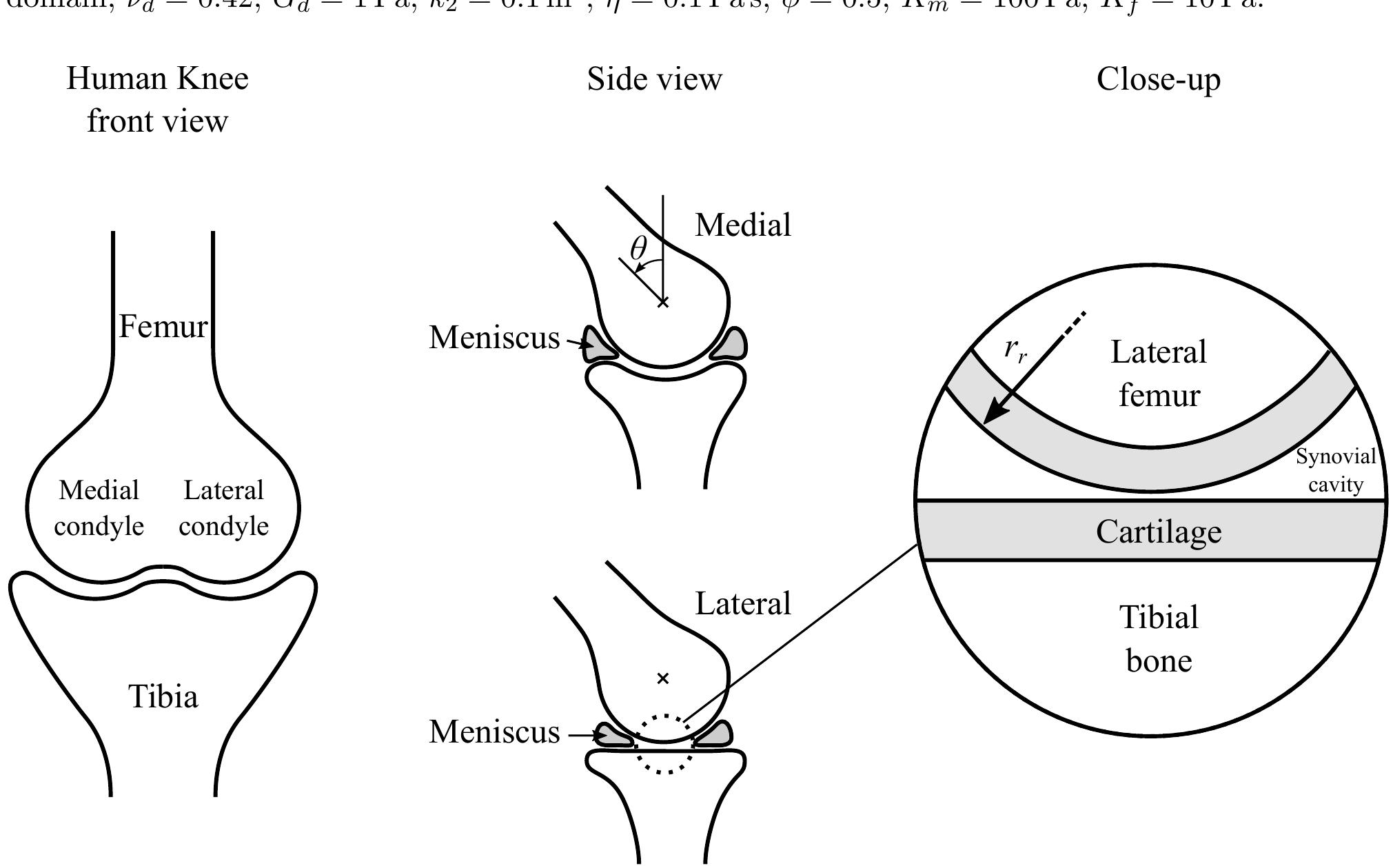 Medial and lateral side of the human knee, and a close-up of