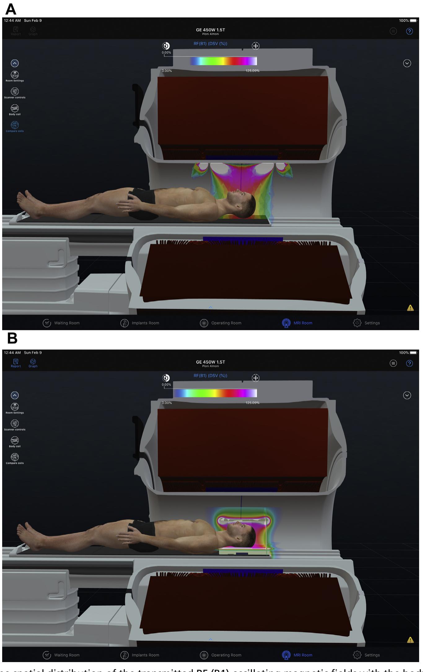 Mr Safe Object (PDF) Standardized Approaches to MR Safety Assessment of Patients with ...