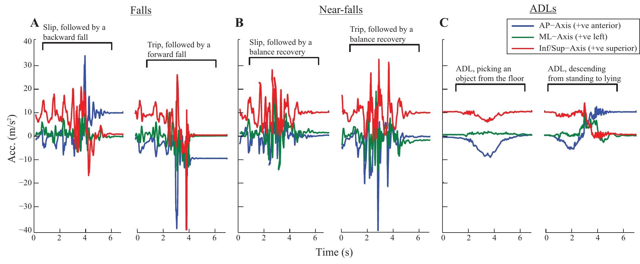 Fall Axially (PDF) A comparison of accuracy of fall detection algorithms (threshold ...