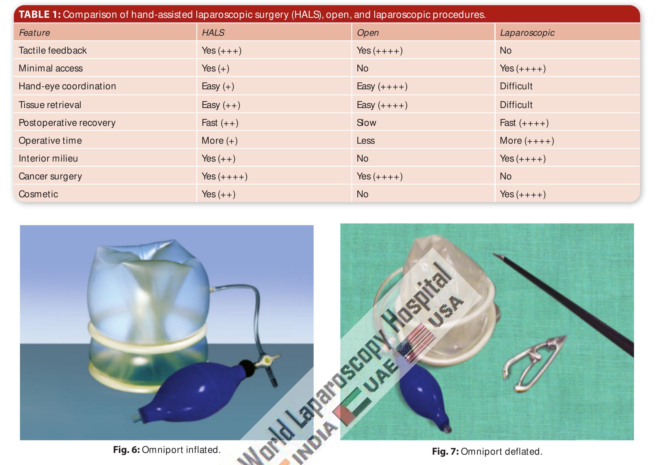 (PDF) Hand-Assisted Laparoscopic Surgery (HALS): Bridging the Gap ...