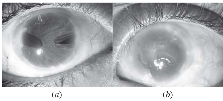 (PDF) Case Reports