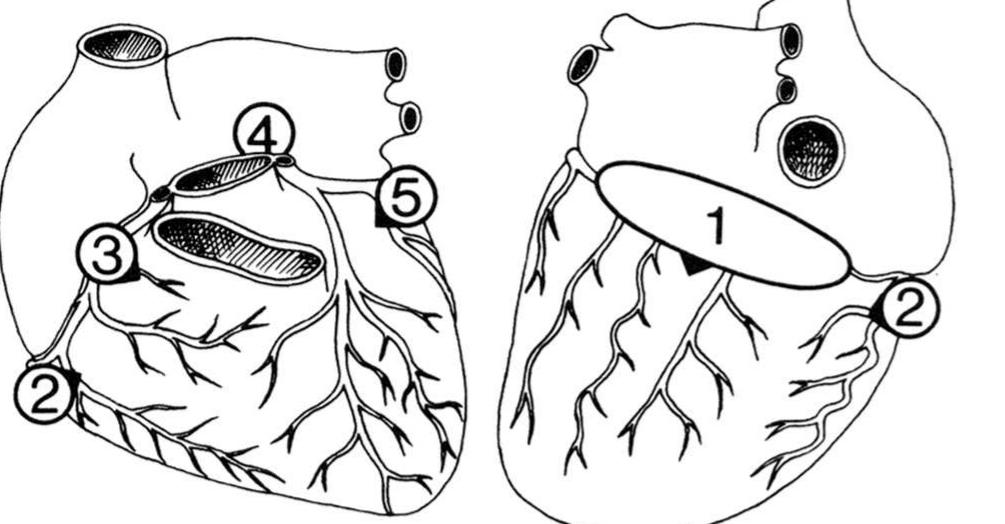 Schematic drawing of the anterior and postero- inferior