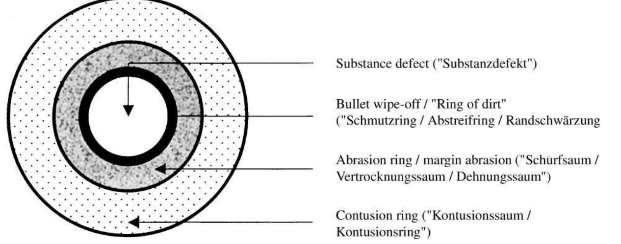 Figure 1. In English and in German the morphological terminology concerning the en- trance wound by a distant gunshot is not completely uniform, therefore the original German terms are included in parentheses (Thali et al., 2002 c).  According to Popov e¢ al. (2002), in the centre of the entrance wound there is a skin defect (deqexm xocu) surrounded by an abrasion ring, which dries up (noscoK ocaduenusA/noscoK é6vicbixanuA). Bullets leave a thin dark-grey layer of metals on the margins of the entrance wound, referred to as a ring of dirt or abrasion ring or ring of metallisation (noacox 3aepa3nenua/noaAcoK OOmupanus/ noscok memassuzayuu) (Table 2). 