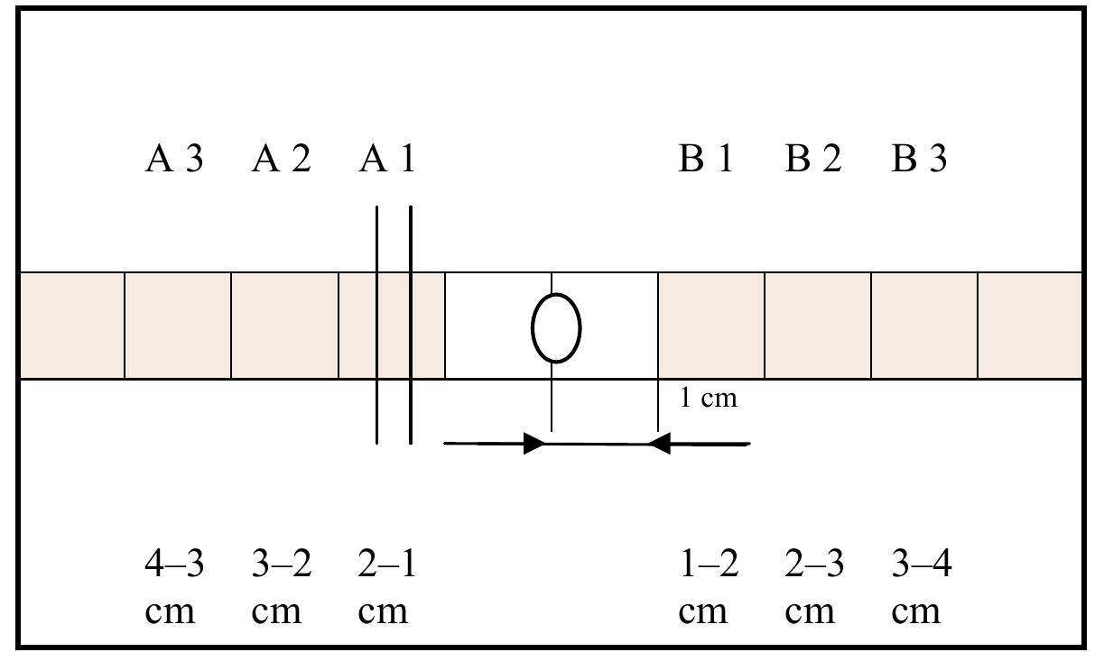 Figure 4. Cutting out of pieces of skin for histological preparations.  Figure 3. Grids on transparent film used to determine the distribution and density of the gunpowder residue particles, impact marks and fibre defects on cloth targets (appli- cation of grids is seen on Figure 8). 