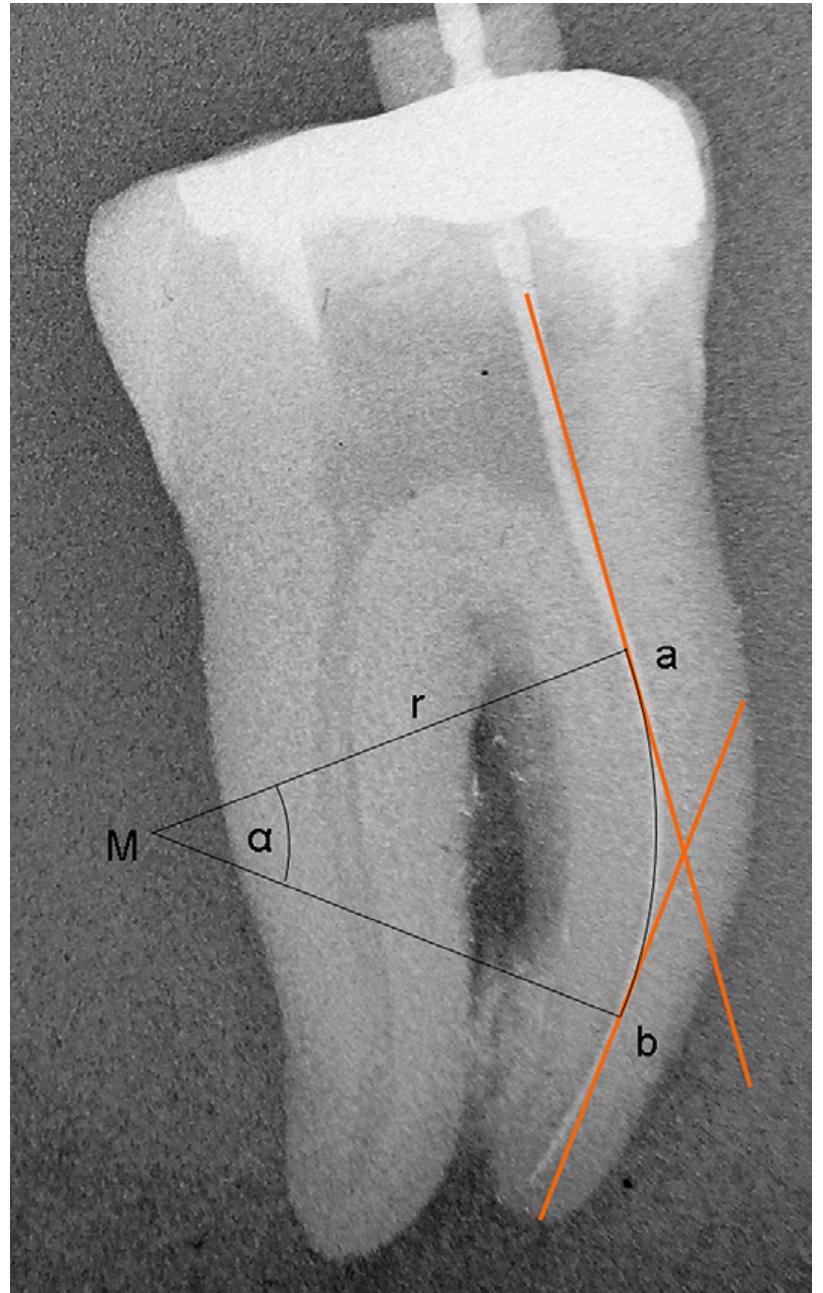 (PDF) Critical evaluation of root canal transportation by instrumentation