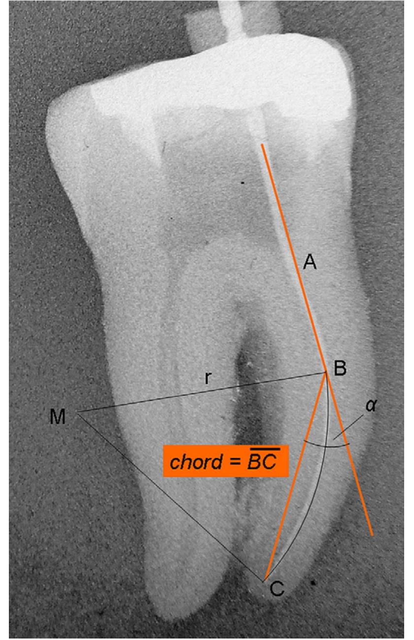 (PDF) Critical evaluation of root canal transportation by instrumentation