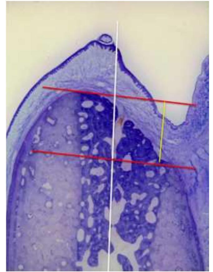 2 Dimensional Ridge Figure 2 - from Dimensional ridge alterations following