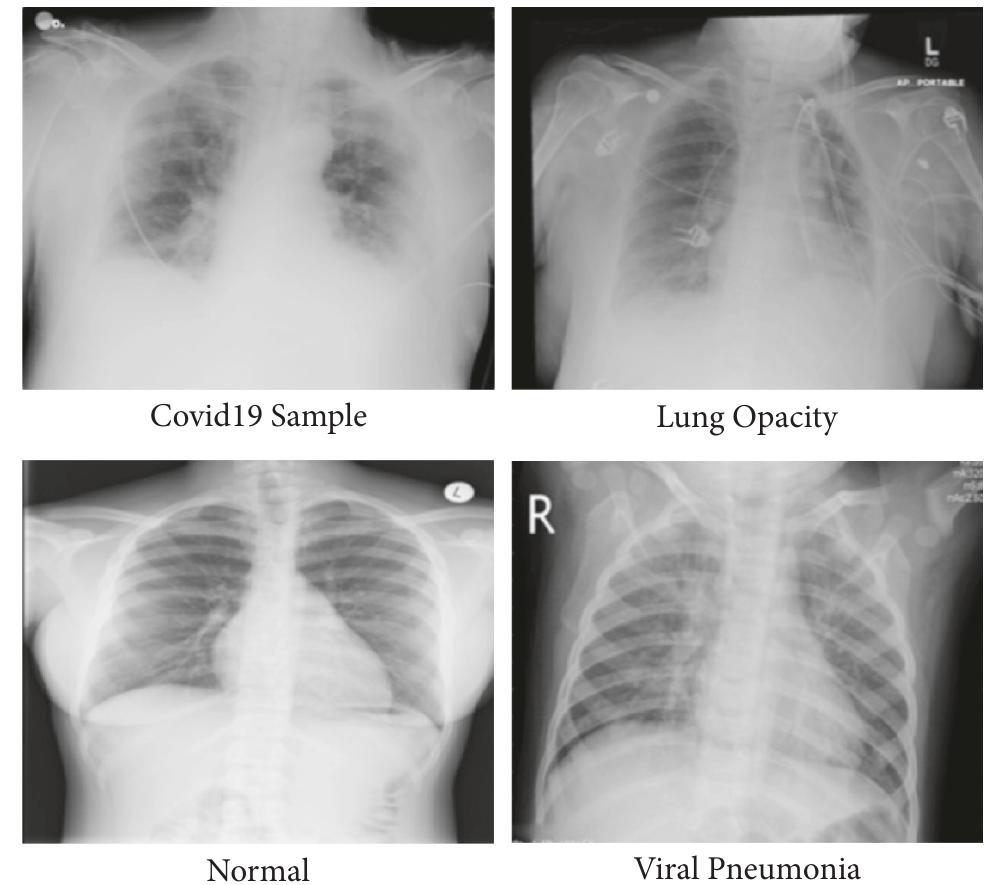 Ficure 1: sample image of covid-19 radiography dataset.