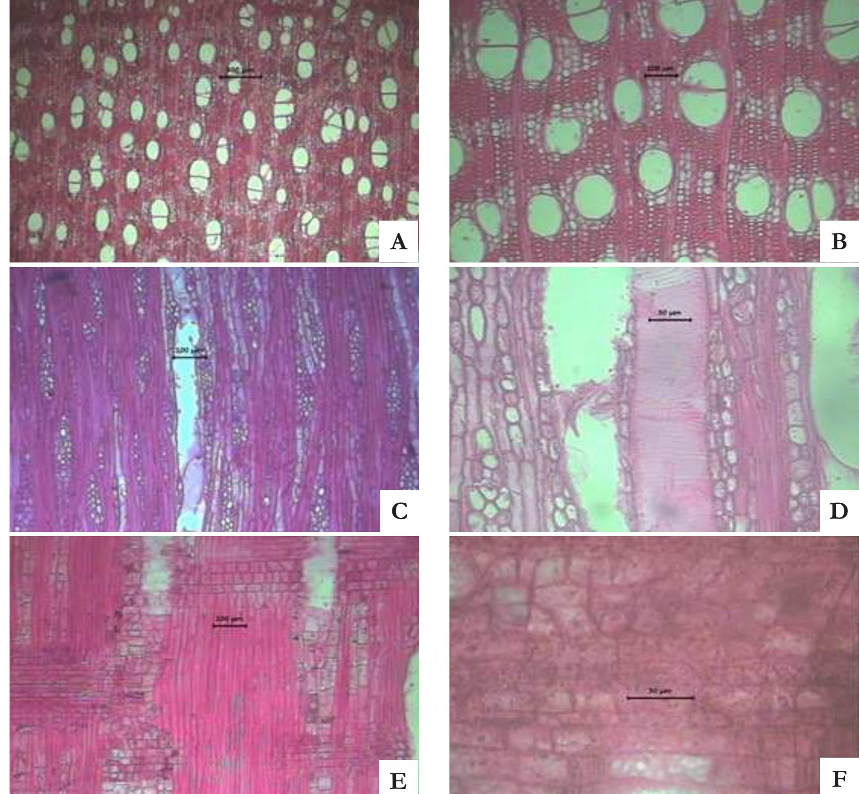 (PDF) Comparative Wood Anatomical Properties of Genus Syzygium (Family ...